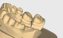 jewelry 3D scanner - Photo of the actual product