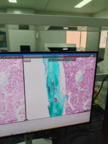 high-throughput slide scanner - Photo of the actual product